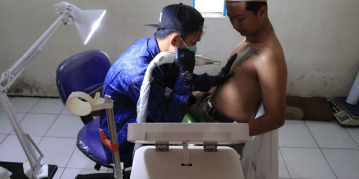 Keren Banget! Di Bandung Ada Tempat Hapus Tato Berbayar Bacaan Al-Quran